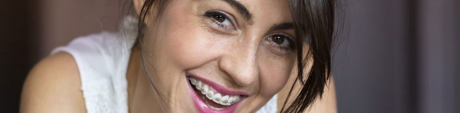 adult braces in peoria