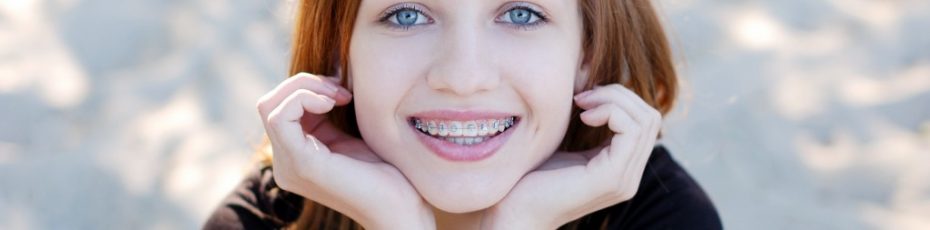 braces for teens in glendale