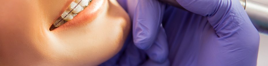 types of orthodontic procedures in phoenix