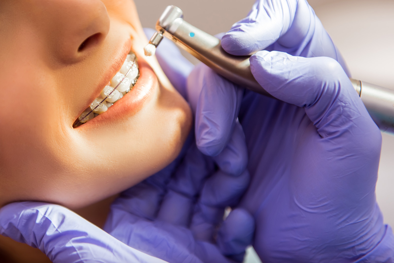 types of orthodontic procedures in phoenix