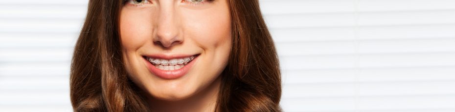why choose clear braces in phoenix