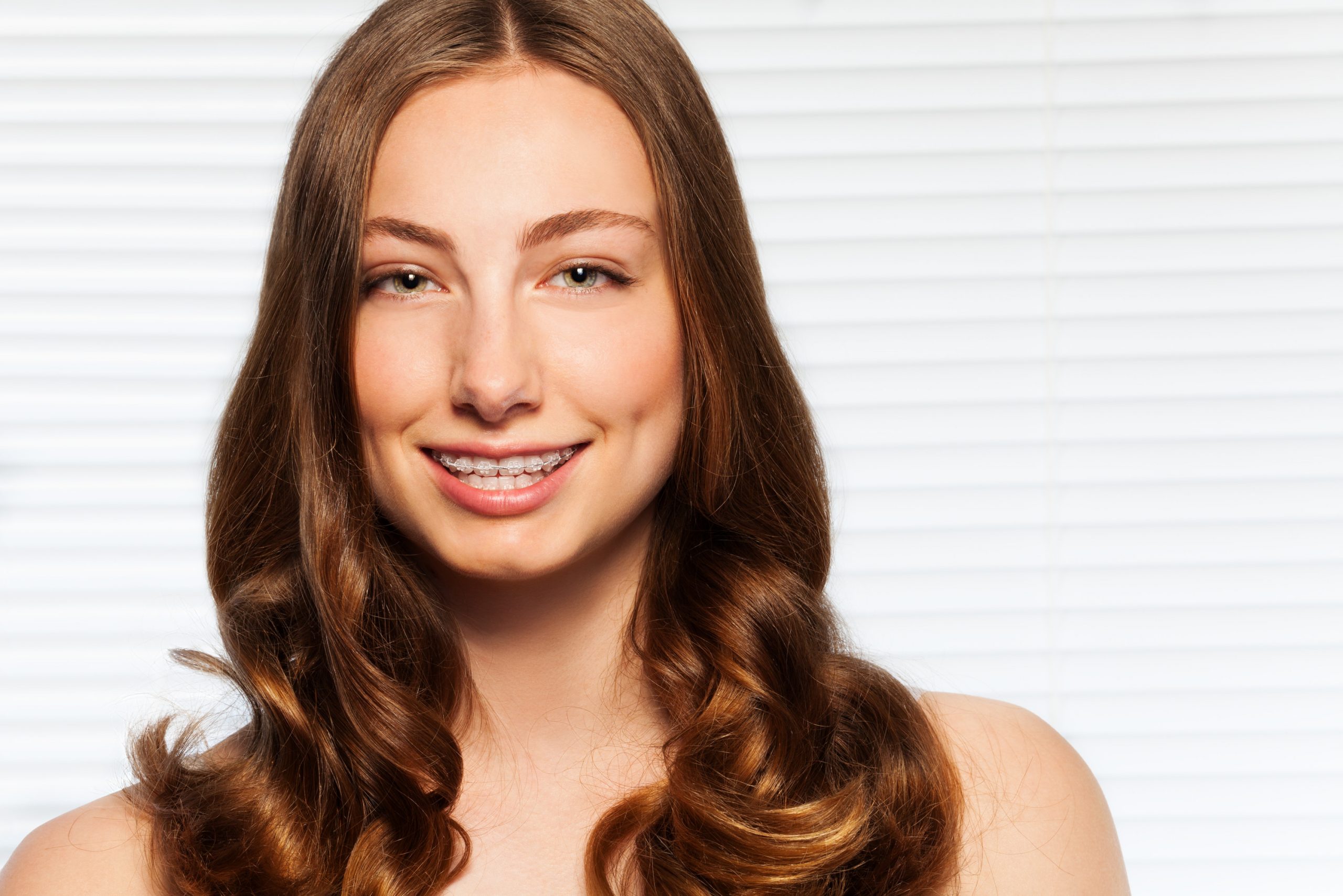 why choose clear braces in phoenix