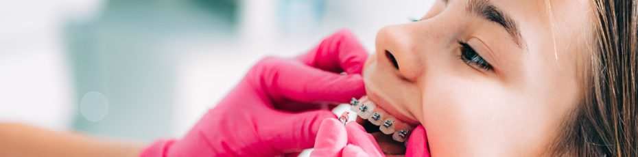 orthodontics for kids