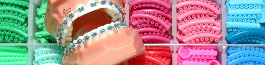 famous faces that have worn braces