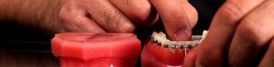 how do you floss with braces