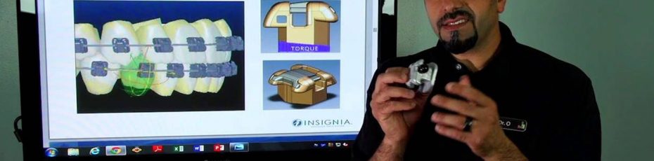 damon braces custom brackets