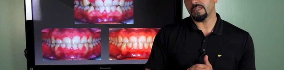 cosmetic dentistry vs orthodontics – which should i choose