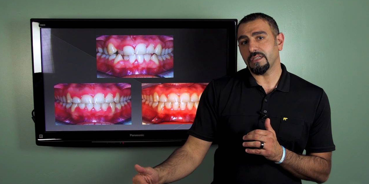 cosmetic dentistry vs orthodontics – which should i choose