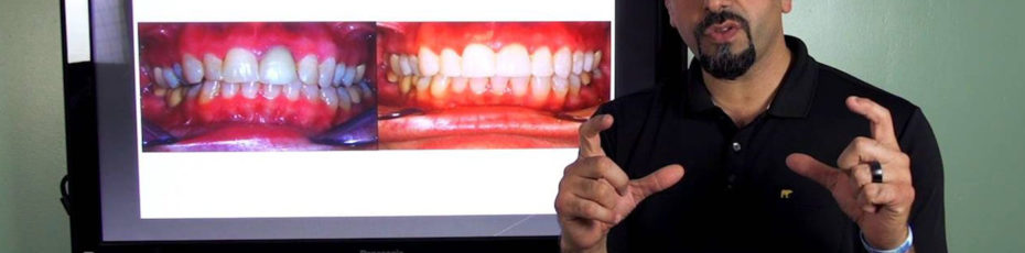 cosmetic dentistry vs orthodontics part 2