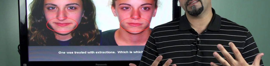 should you extract teeth for orthodontic treatment