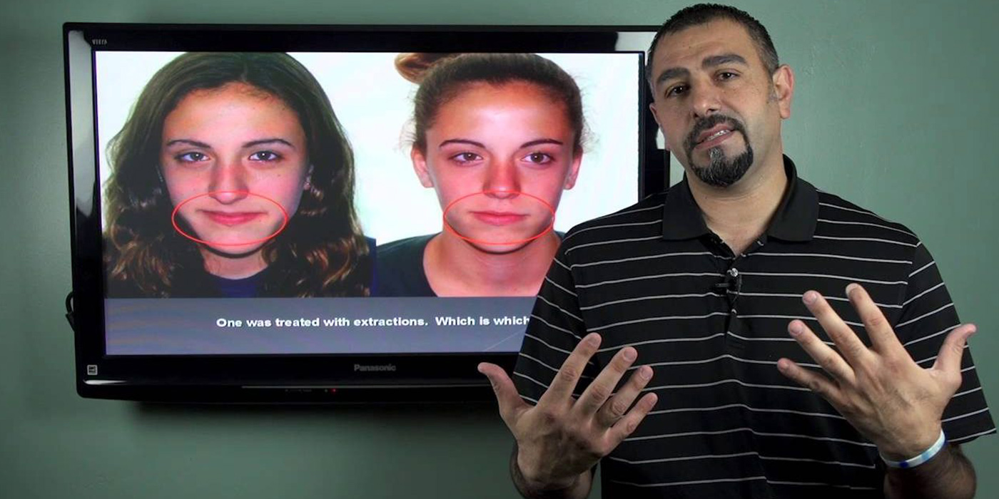 should you extract teeth for orthodontic treatment