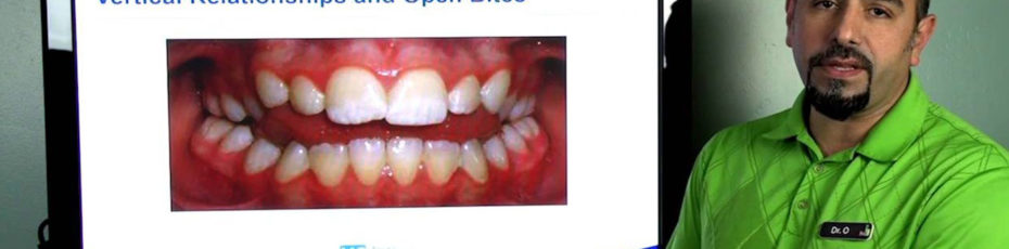 what is an open bite