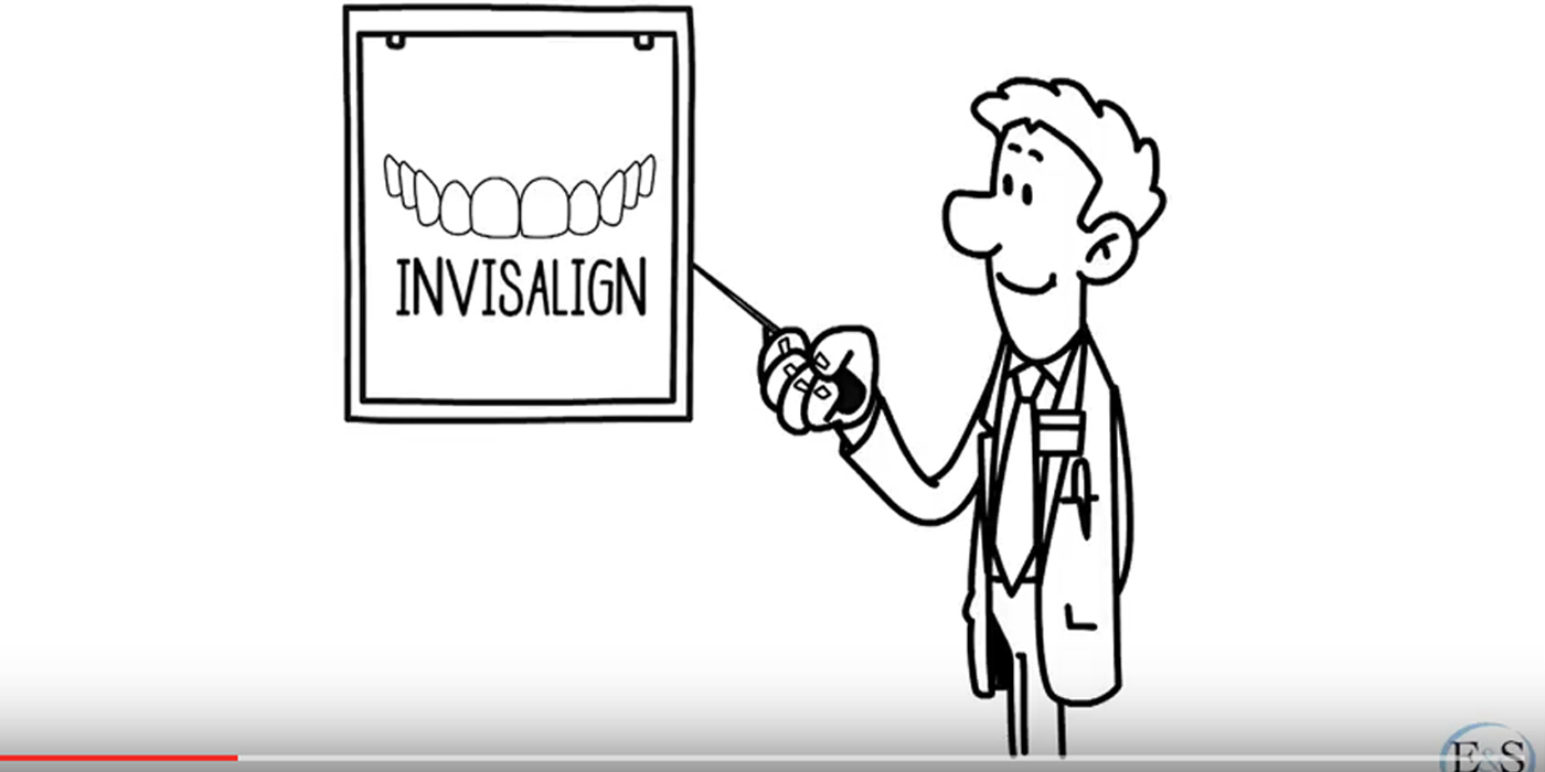 long invisalign treatment take