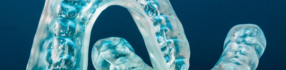 invisalign is worth or not in phoenix