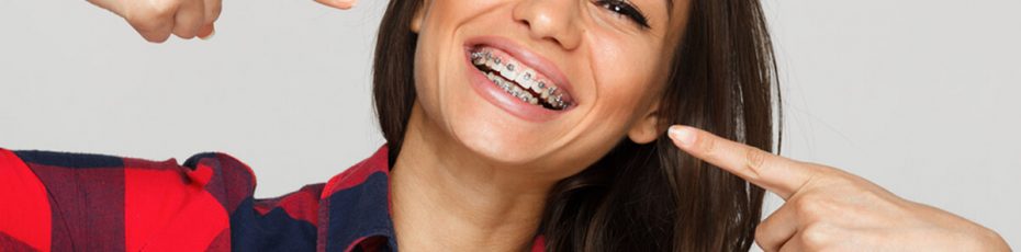 damon braces vs traditional metal braces