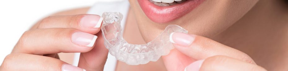 how does the invisalign process work