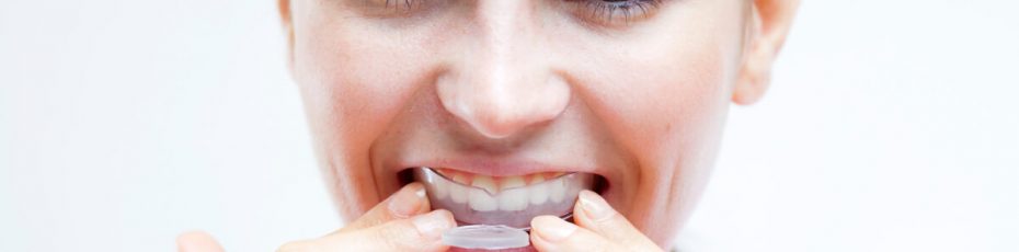 your guide to mouthguards