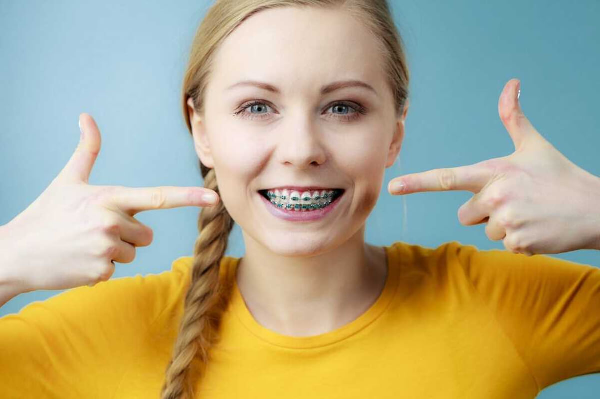 5 common misconceptions about braces