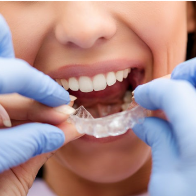 orthodontic retainers in peoria