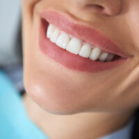 smile transformation: how gum contouring can enhance your appearance