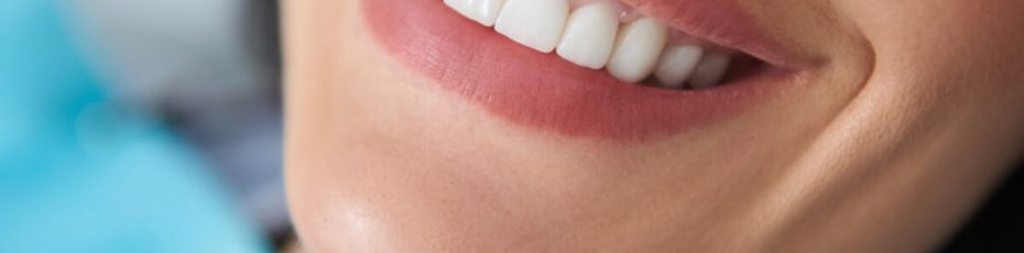 smile transformation: how gum contouring can enhance your appearance
