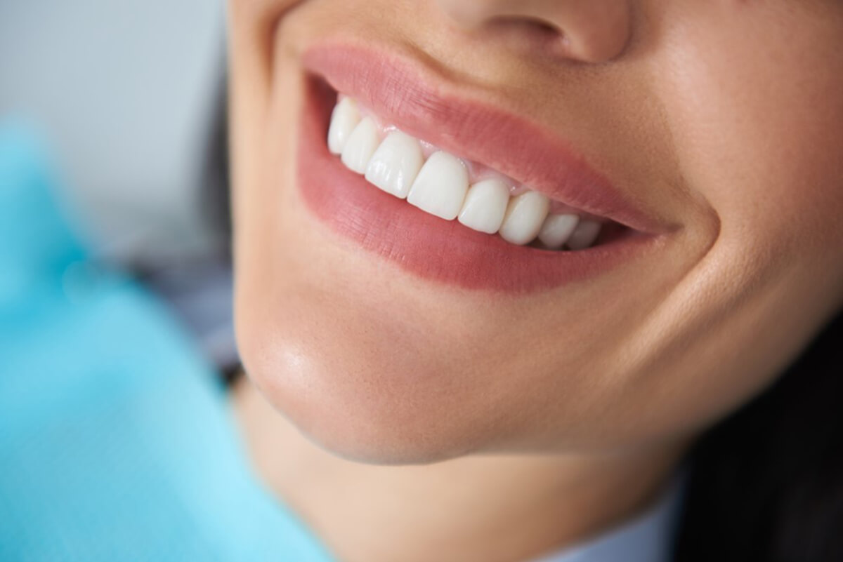 smile transformation: how gum contouring can enhance your appearance